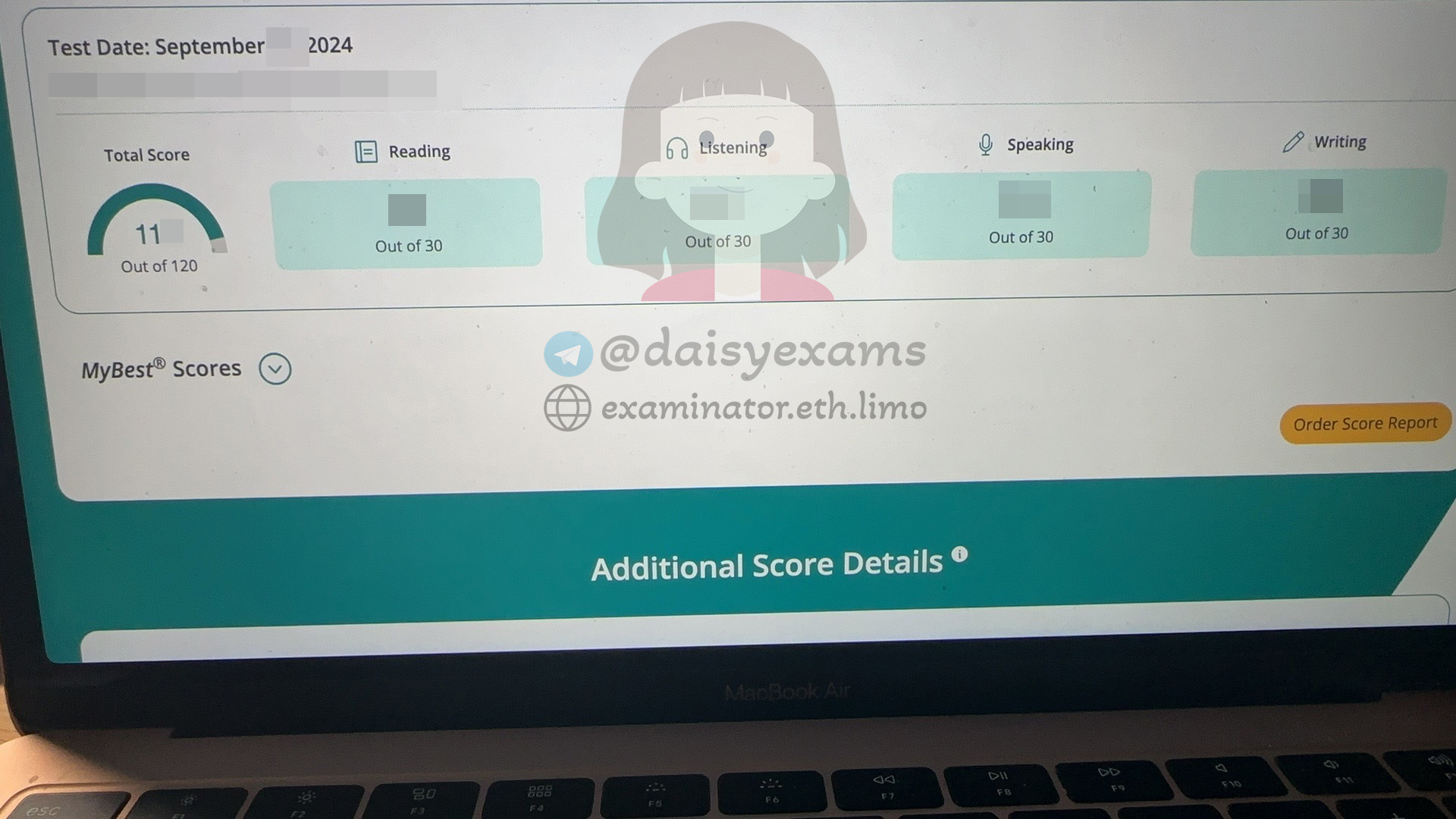 How a Student Achieved 110+ in the TOEFL Exam with TOEFL Cheating Assistance: Tips for Speaking Section✨